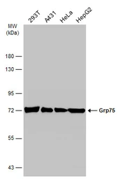 Anti-Grp75 antibody used in Western Blot (WB). GTX104407