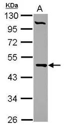 Anti-PCYT2 antibody used in Western Blot (WB). GTX104462