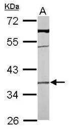 Anti-TMEM59 antibody used in Western Blot (WB). GTX104486