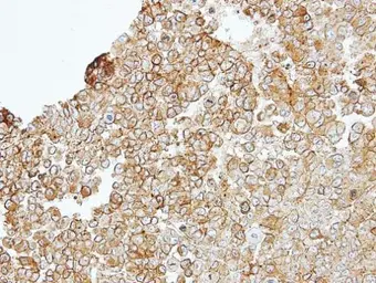 Anti-JAM-B antibody used in IHC (Paraffin sections) (IHC-P). GTX104507