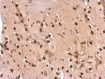 Anti-ETS2 antibody used in IHC (Paraffin sections) (IHC-P). GTX104527
