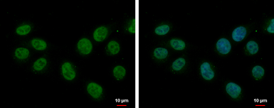 Anti-Splicing factor 1 antibody [N1N3] used in Immunocytochemistry/ Immunofluorescence (ICC/IF). GTX104540