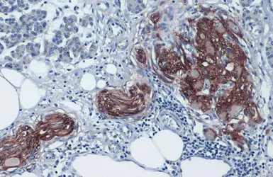 Anti-Glypican 1 antibody [N3C3] used in IHC (Paraffin sections) (IHC-P). GTX104557