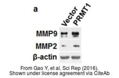 Anti-MMP2 antibody used in Western Blot (WB). GTX104577
