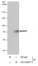 Anti-MMP2 antibody used in Immunoprecipitation (IP). GTX104577