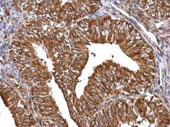 Anti-MMP2 antibody used in IHC (Paraffin sections) (IHC-P). GTX104577