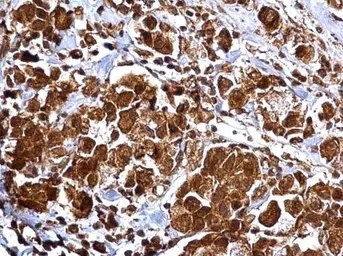 Anti-MMP2 antibody used in IHC (Paraffin sections) (IHC-P). GTX104577
