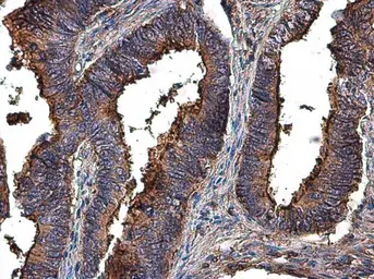 Anti-MMP2 antibody used in IHC (Paraffin sections) (IHC-P). GTX104577