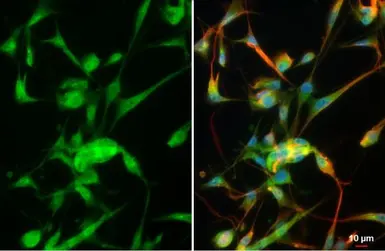 Anti-MMP2 antibody used in Immunocytochemistry/ Immunofluorescence (ICC/IF). GTX104577