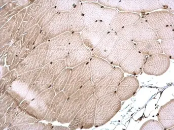 Anti-CSB antibody [N2C1], Internal used in IHC (Paraffin sections) (IHC-P). GTX104589
