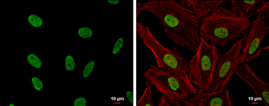 Anti-CSB antibody [N2C1], Internal used in Immunocytochemistry/ Immunofluorescence (ICC/IF). GTX104589