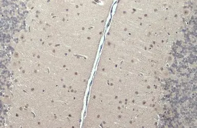 Anti-CSB antibody [N2C1], Internal used in IHC (Paraffin sections) (IHC-P). GTX104589