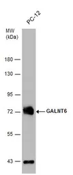 Anti-GALNT6 antibody [N1C2] used in Western Blot (WB). GTX104602