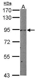 Anti-STAT3 antibody [C3], C-term used in Western Blot (WB). GTX104616