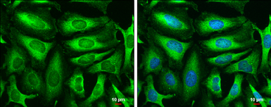 Anti-Triosephosphate isomerase antibody [C2C3], C-term used in Immunocytochemistry/ Immunofluorescence (ICC/IF). GTX104618