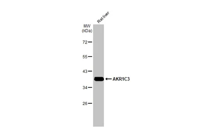 Anti-AKR1C3 antibody [C2C3], C-term used in Western Blot (WB). GTX104627