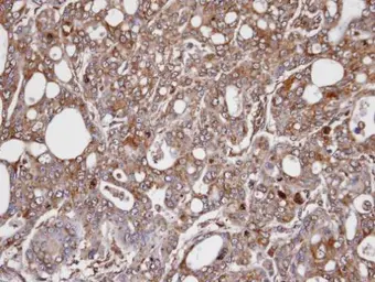 Anti-AKR1C3 antibody [C2C3], C-term used in IHC (Paraffin sections) (IHC-P). GTX104627