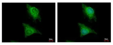 Anti-Laforin antibody [C2C3], C-term used in Immunocytochemistry/ Immunofluorescence (ICC/IF). GTX104648