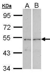 Anti-CPEB1 antibody [C3], C-term used in Western Blot (WB). GTX104682