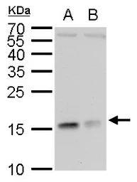 Anti-RPL37 antibody used in Western Blot (WB). GTX104688