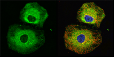 Anti-Stathmin 1 antibody used in Immunocytochemistry/ Immunofluorescence (ICC/IF). GTX104707