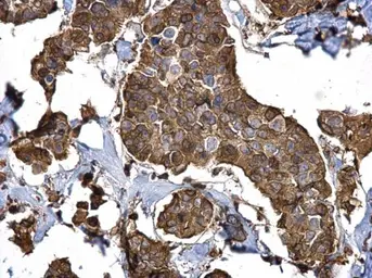 Anti-Stathmin 1 antibody used in IHC (Paraffin sections) (IHC-P). GTX104707