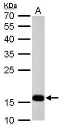 Anti-Stathmin 1 antibody used in Western Blot (WB). GTX104707