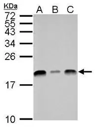 Anti-UBE2L3 antibody used in Western Blot (WB). GTX104717