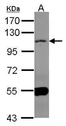 Anti-MAML1 antibody [N1], N-term used in Western Blot (WB). GTX104748
