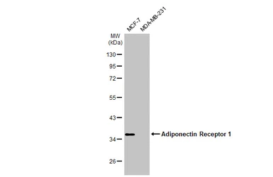 Anti-Adiponectin Receptor 1 antibody [C2C3], C-term used in Western Blot (WB). GTX104770