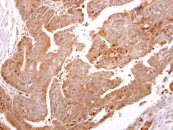 Anti-ARF3 antibody used in IHC (Paraffin sections) (IHC-P). GTX104782
