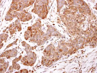 Anti-ARF5 antibody used in IHC (Paraffin sections) (IHC-P). GTX104783