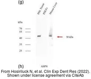 Anti-Asporin antibody [N3C1], Internal used in Western Blot (WB). GTX104790