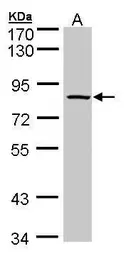 Anti-ADAM33 antibody [C2C3], C-term used in Western Blot (WB). GTX104804