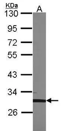 Anti-TFEC antibody [N1], N-term used in Western Blot (WB). GTX104824