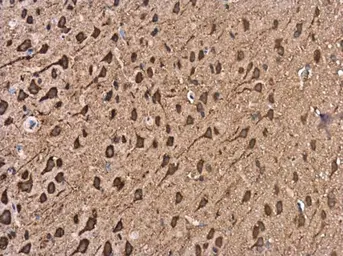 Anti-KIF5A antibody [C3], C-term used in IHC (Paraffin sections) (IHC-P). GTX104875