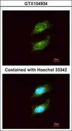 Anti-PKA C alpha antibody [N2C3] used in Immunocytochemistry/ Immunofluorescence (ICC/IF). GTX104934