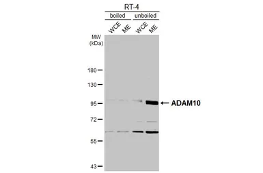 Anti-ADAM10 antibody [N2C1], Internal used in Western Blot (WB). GTX104940