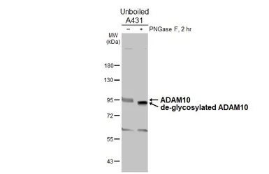 Anti-ADAM10 antibody [N2C1], Internal used in Western Blot (WB). GTX104940
