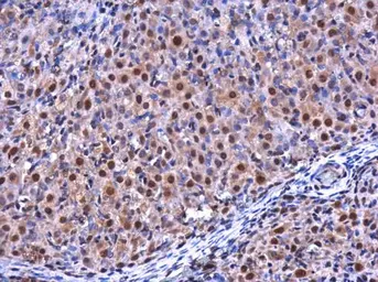 Anti-RGS2 antibody used in IHC (Paraffin sections) (IHC-P). GTX104944