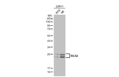Anti-RGS2 antibody used in Western Blot (WB). GTX104944