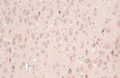 Anti-CYP26A1 antibody used in IHC (Paraffin sections) (IHC-P). GTX104961