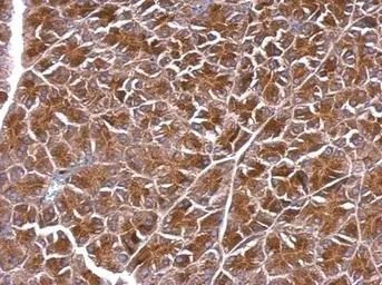 Anti-BPNT1 antibody [N1C3] used in IHC (Paraffin sections) (IHC-P). GTX104970