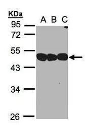 Anti-NSFL1C antibody [N1C2] used in Western Blot (WB). GTX105035