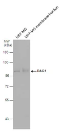 Anti-DAG1 antibody used in Western Blot (WB). GTX105038