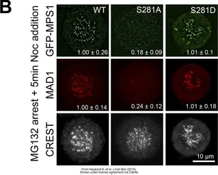 Anti-MAD1 antibody used in Immunocytochemistry/ Immunofluorescence (ICC/IF). GTX105079