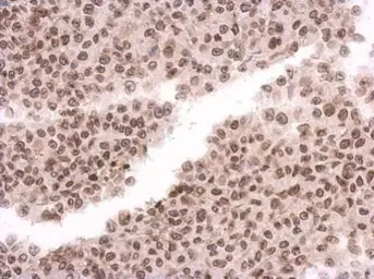 Anti-MAD1 antibody used in IHC (Paraffin sections) (IHC-P). GTX105079