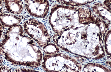 Anti-LOXL2 antibody used in IHC (Paraffin sections) (IHC-P). GTX105085