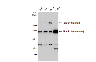 Anti-Fibulin 2 antibody used in Western Blot (WB). GTX105108