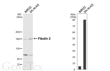 Anti-Fibulin 2 antibody used in Western Blot (WB). GTX105108